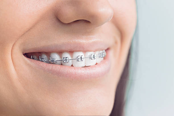Best Invisalign and Clear Aligners  in East Bakersfield, CA